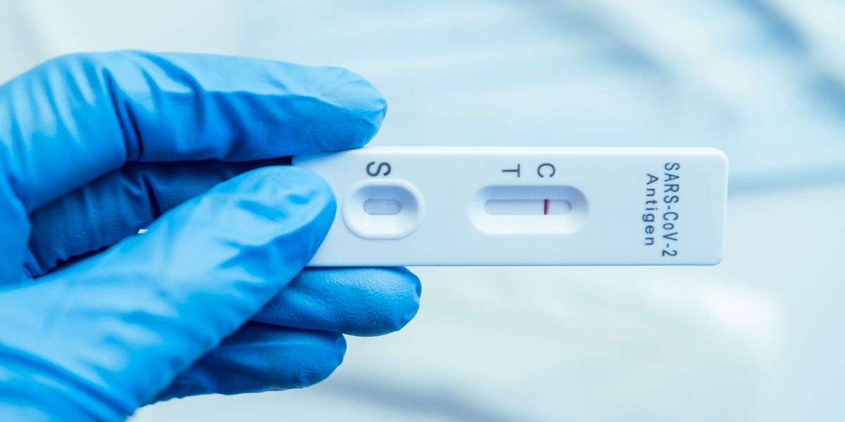 What is an Antigen test and how to do it? | Best Agencies